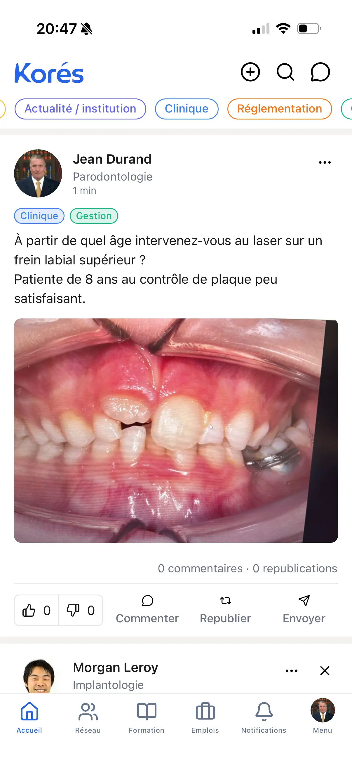 Kores app feed screen